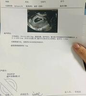希望天下母子好结果