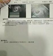 母狗想被爸爸们认出来，找到母狗，操坏母狗