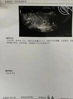 实锤了就是这一次发小把老婆操怀孕的过程0