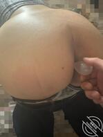 记录(25)妈妈最近便秘，帮妈妈上开塞露2