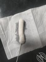 女儿的小b为什么不吸收