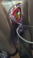 地铁抄底偷拍1