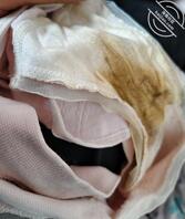 我妹好像被干出病了，逼里有分泌物把内裤都搞变色了还闻着味道好骚1