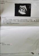 二十二) 带着女儿去流掉孩子2