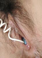 ?1